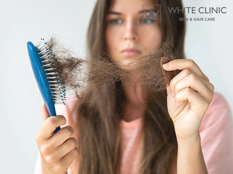 Rụng Tóc Do Stress: Hiểu Rõ Nguyên Nhân Và Giải Pháp Phục Hồi Mái Tóc Chắc Khỏe