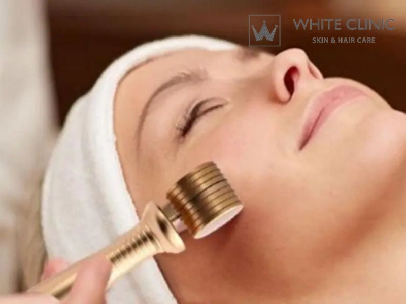 Lăn kim trị sẹo rỗ: Phân loại sẹo, phác đồ điều trị và tiêu chuẩn an toàn tại White Clinic