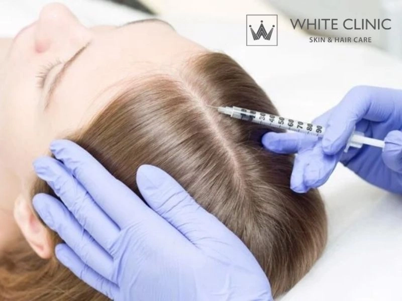 Meso Có Mấy Loại? Hiểu Đúng Để Chọn Đúng Hướng Điều Trị Cho Từng Tình Trạng Tóc
