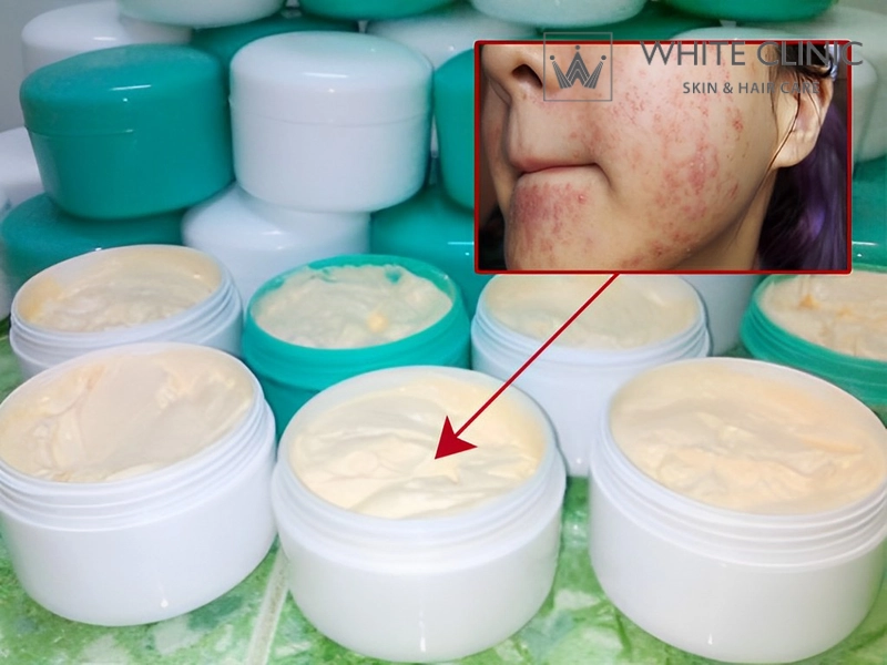 tác hại của kem trộn tác hại của kem trộn