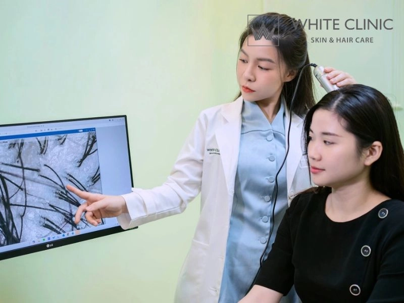 Cách chăm sóc và phòng ngừa rụng tóc chân trắng tại nhà hiệu quả