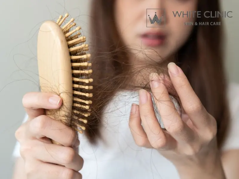 rụng tóc ở tuổi dậy thì