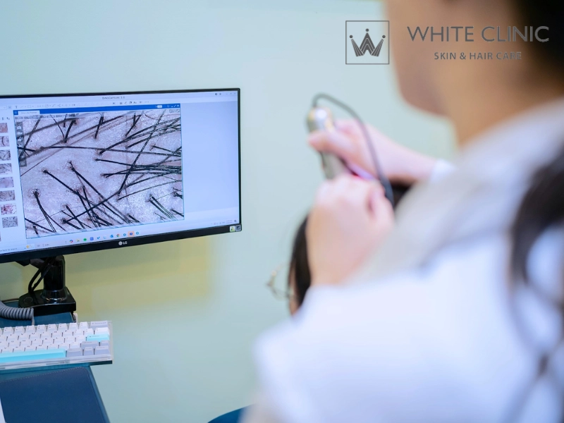 White Clinic là lựa chọn hàng đầu cho các vấn đề về da đầu White Clinic là lựa chọn hàng đầu cho các vấn đề về da đầu