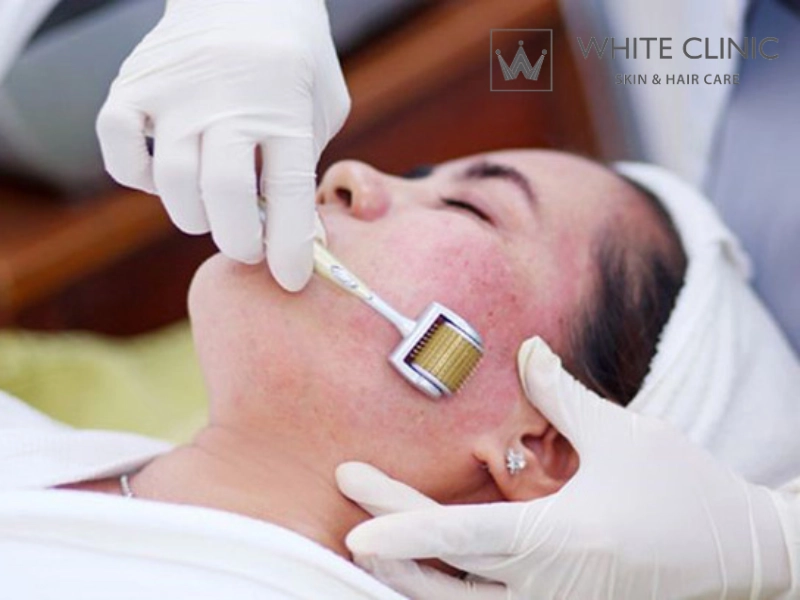 Rủi ro khi lăn kim và cách kiểm soát biến chứng Rủi ro khi lăn kim và cách kiểm soát biến chứng