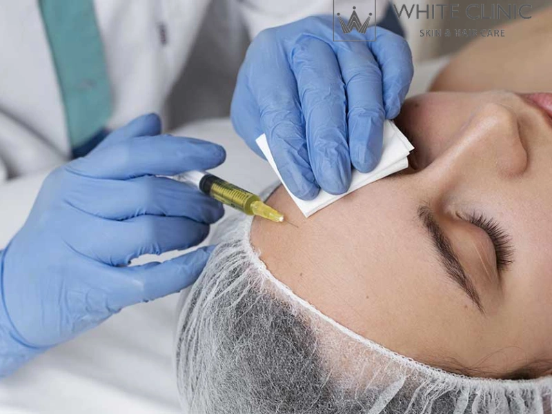 PRP Làm Đẹp Da: Liệu Pháp Neogen Tái Tạo Và Trị Sẹo Rỗ Tại White Clinic