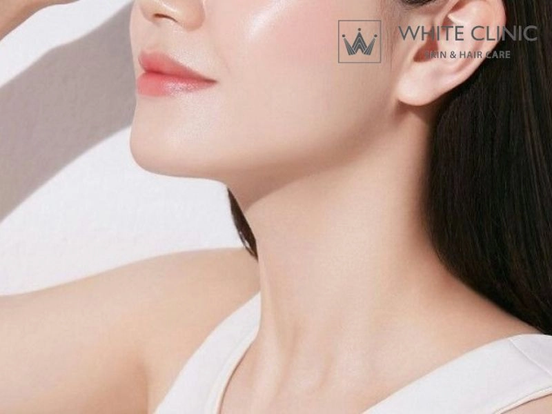 Duy trì làn da sạch mịn và ngăn ngừa mụn tái phát sau điều trị