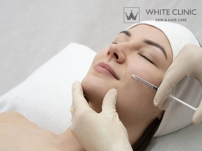 Tiêm Meso Trị Mụn Mang Lại Giải Pháp Kiểm Soát Dầu Và Trẻ Hóa Da Tại White Clinic 