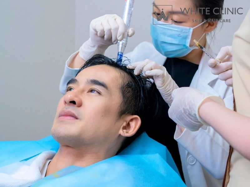 rụng tóc di truyền 