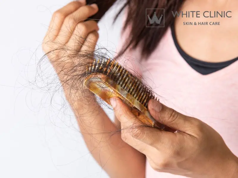 Vì Sao Tóc Rụng Nhiều Ở Nữ? Nguyên Nhân Và Cách Điều Trị Hợp Lý 