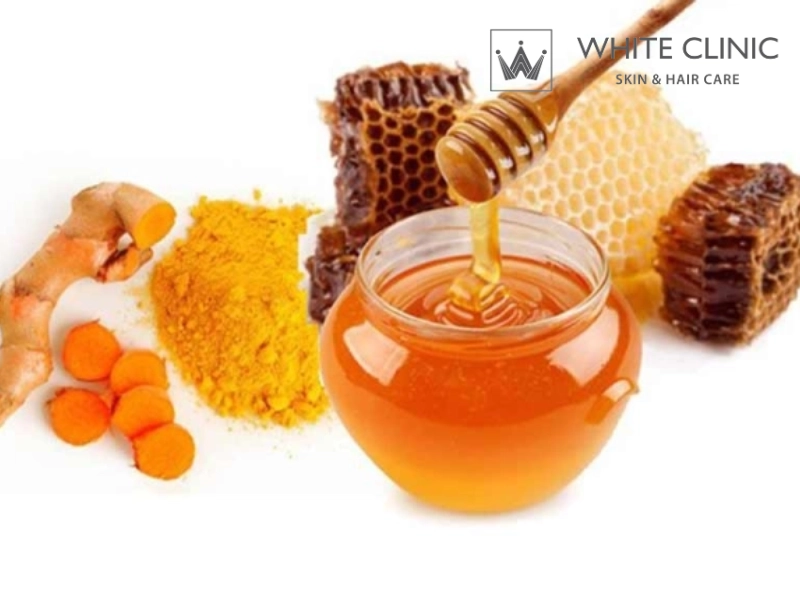 trị mụn bằng nghệ