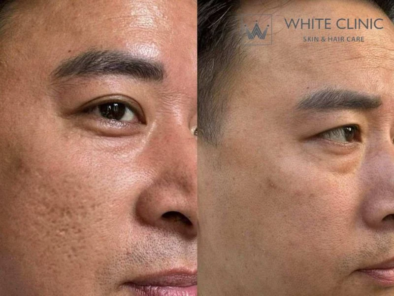Tiêu chí cá nhân hóa phác đồ & Quản lý rủi ro Tiêu chí cá nhân hóa phác đồ & Quản lý rủi ro