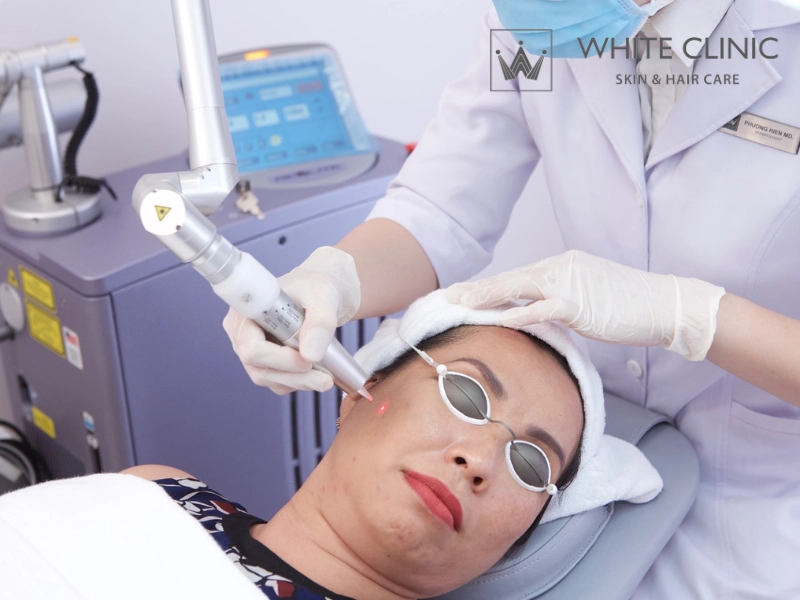 trị mụn bằng tràm trà