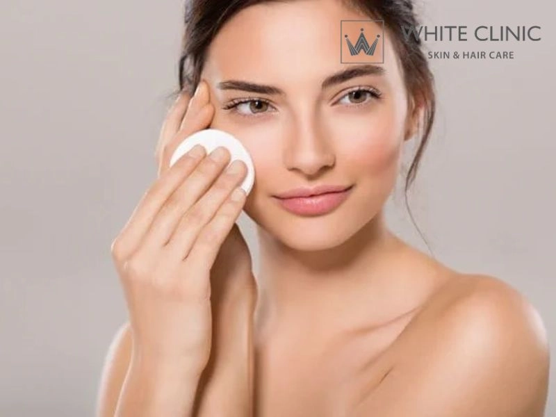 Cách chăm sóc và phòng ngừa mụn đầu trắng tái phát bền vững