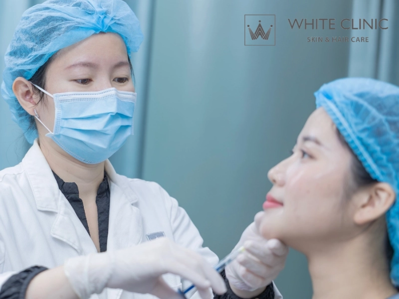 các loại filler được cấp phép