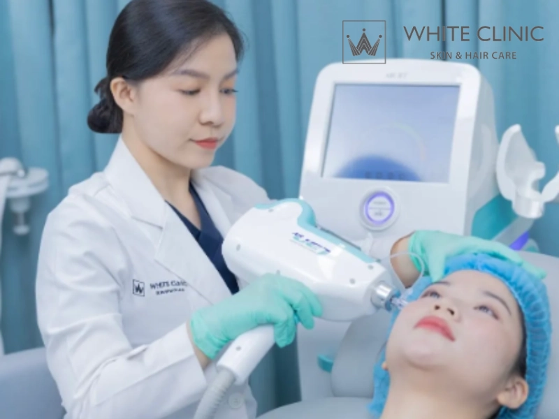 cách trị sẹo rỗ đáy nhọn