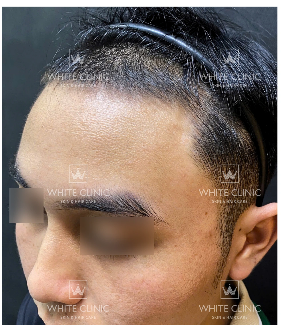 Bạn Nguyễn Hải Đ