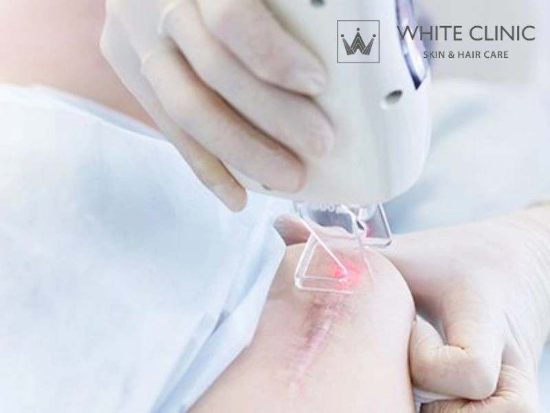 Tiêu chí chọn bác sĩ và cơ sở điều trị sẹo co rút uy tín Tiêu chí chọn bác sĩ và cơ sở điều trị sẹo co rút uy tín