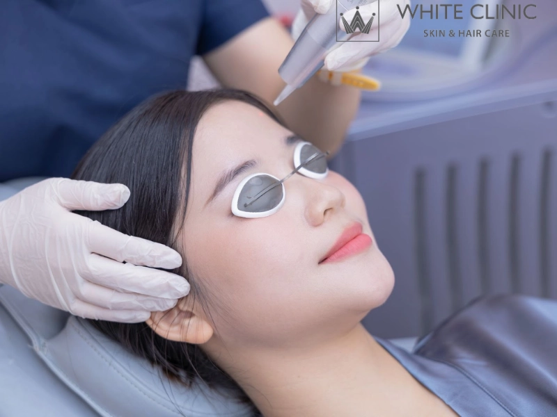 căng bóng da mặt 