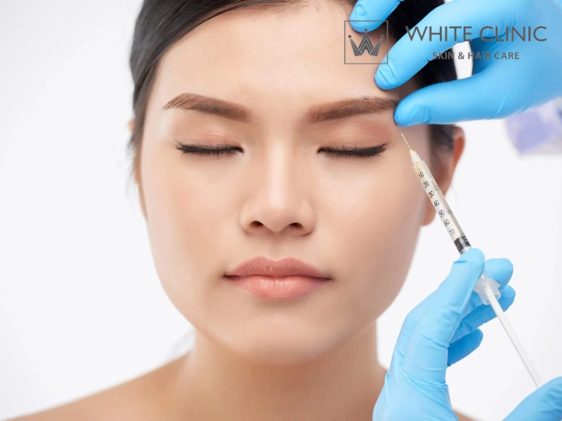 Tiêm Botox Xóa Nhăn Mắt: Cách Xác Định Tình Trạng Và Lựa Chọn Phác Đồ Phù Hợp