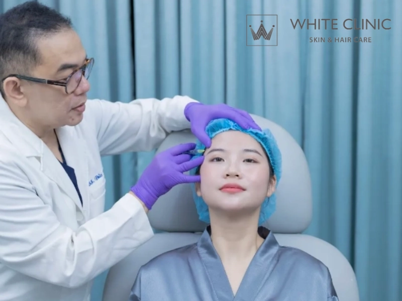 kỹ thuật tiêm filler môi kỹ thuật tiêm filler môi