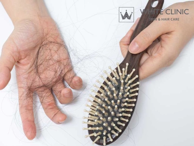 rụng tóc khi mang thai