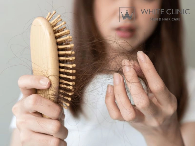 rụng tóc nhiều ở nữ tuổi 17 có sao không