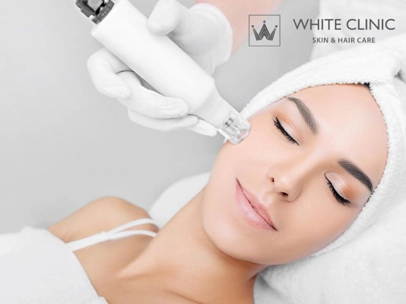 Phân tích các phương pháp can thiệp sẹo đáy vuông hiện nay