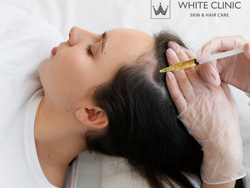 cách trị tóc thưa