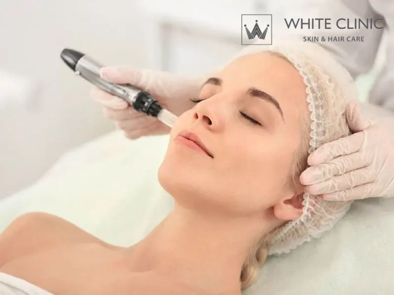 chăm sóc da sau laser co2 chăm sóc da sau laser co2