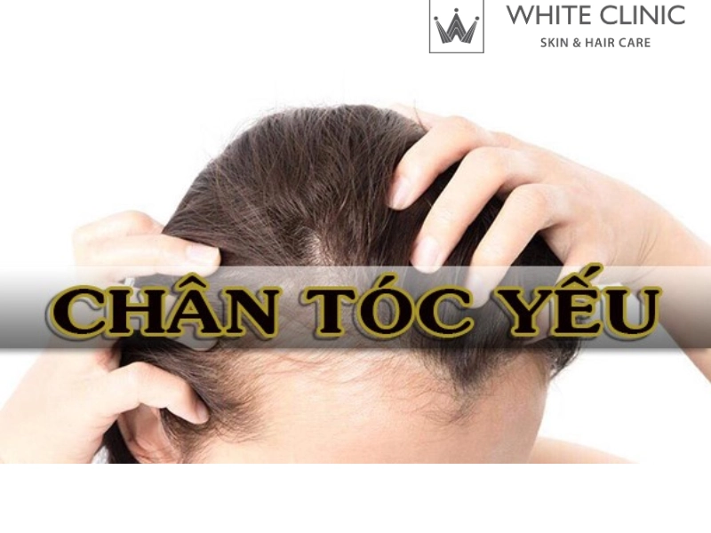 chân tóc yếu