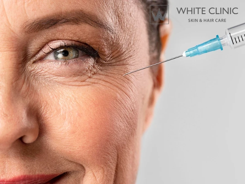 Lựa chọn Filler HA chất lượng và địa chỉ tiêm uy tín Lựa chọn Filler HA chất lượng và địa chỉ tiêm uy tín