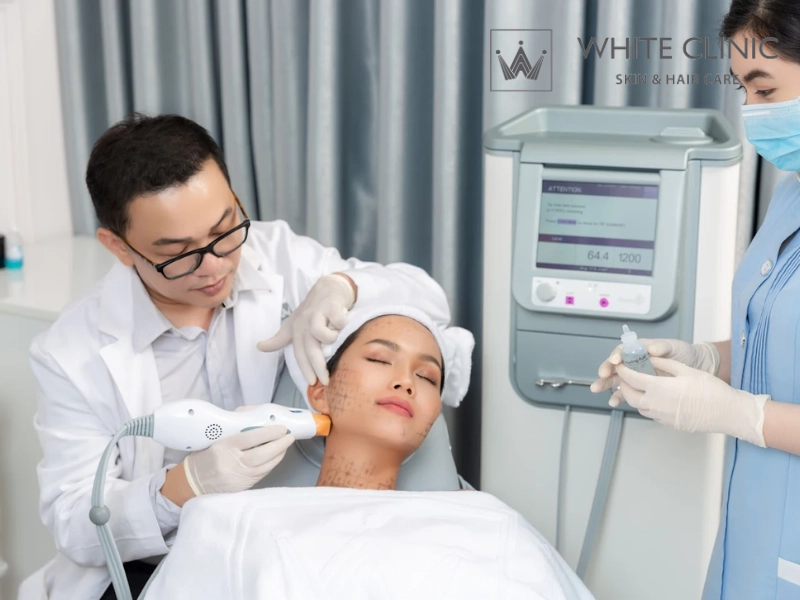 chanh có trị mụn không