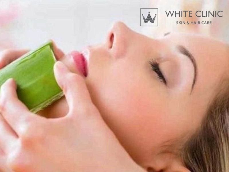 cách trị mụn băng nha đam