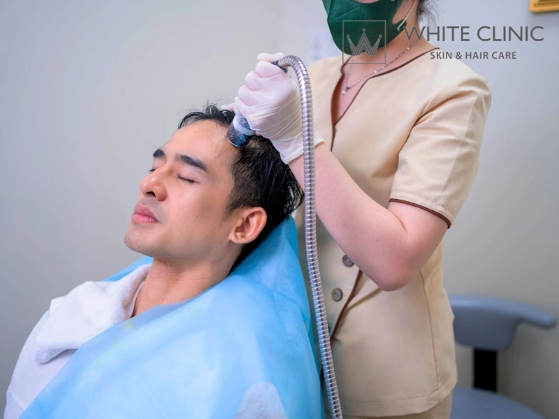 tóc rụng không rõ nguyên nhân tóc rụng không rõ nguyên nhân