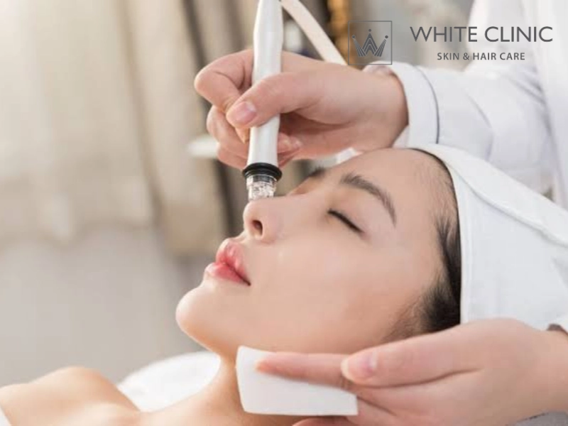 cách hết thâm mụn trong 1 tuần