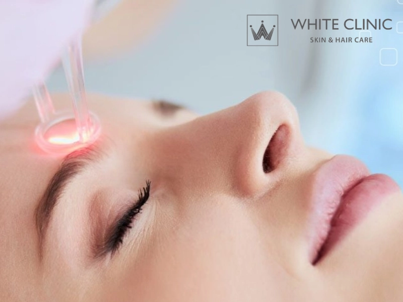 Những yếu tố ảnh hưởng đến mức độ đau khi điều trị Laser Những yếu tố ảnh hưởng đến mức độ đau khi điều trị Laser