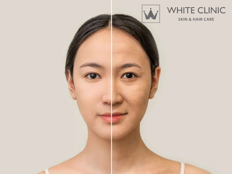 Đối tượng phù hợp với liệu trình BIOLIFT 20 Đối tượng phù hợp với liệu trình BIOLIFT 20