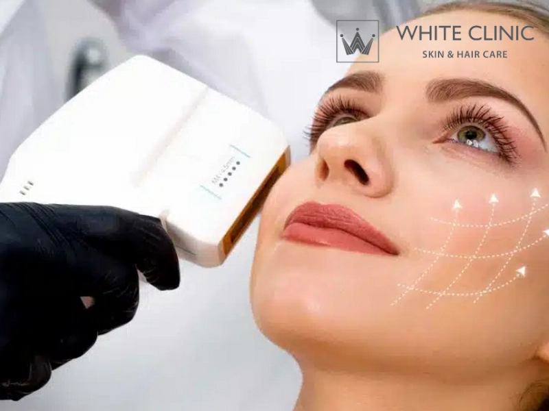 công nghệ làm đẹp hifu công nghệ làm đẹp hifu
