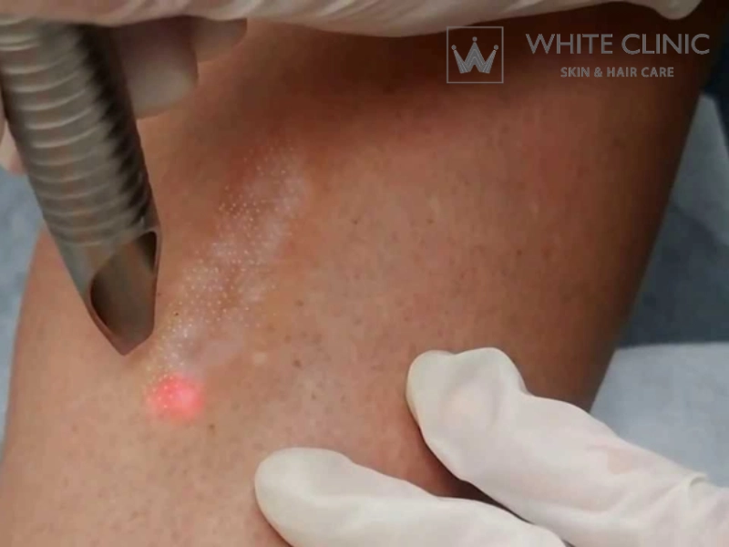 Tiêu chí chọn nơi điều trị và quy trình tiếp cận tại White Clinic Tiêu chí chọn nơi điều trị và quy trình tiếp cận tại White Clinic