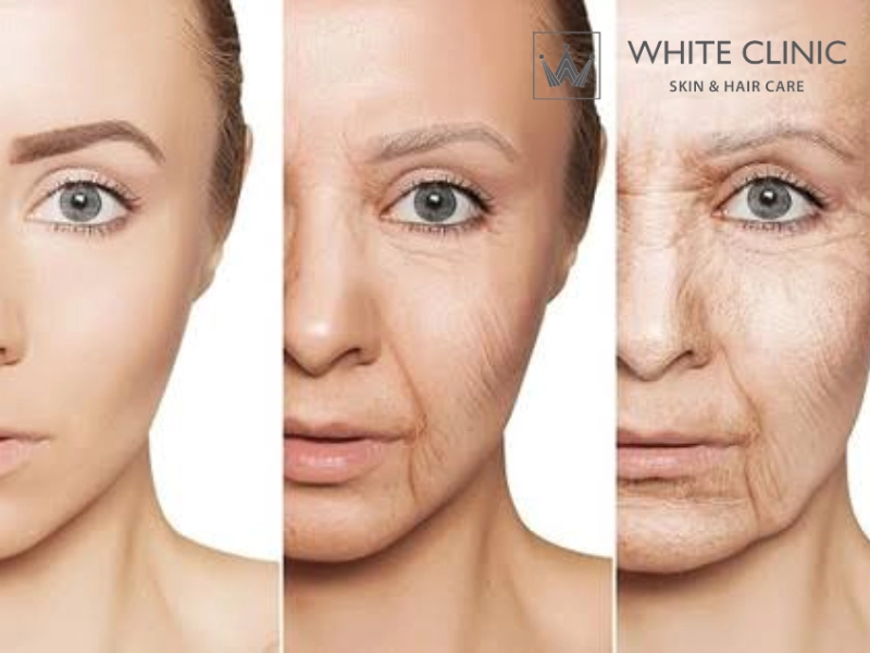 Chi Phí Tiêm Profilo: Cách Tính Tổng Liệu Trình Để Đạt Hiệu Quả Tối Ưu