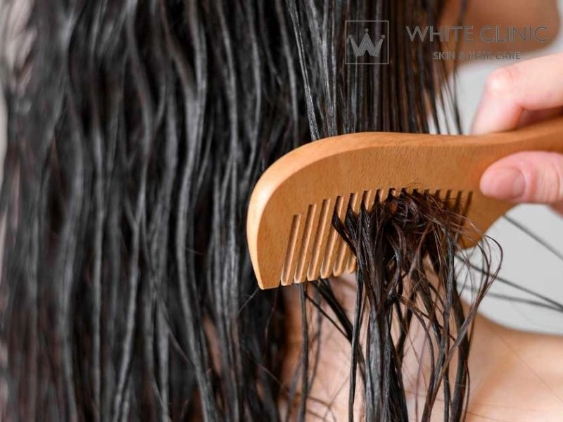 da đầu nhờn tóc bết da đầu nhờn tóc bết