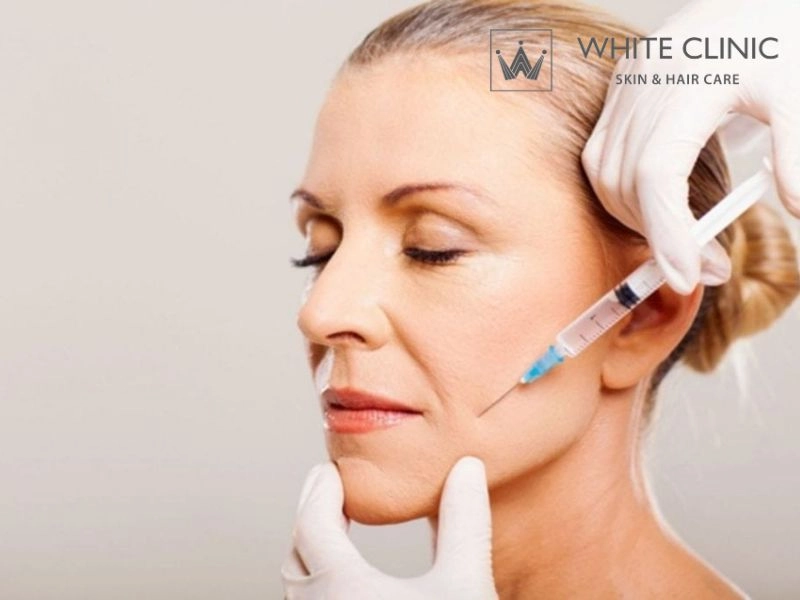 botox có tác dụng trong bao lâu botox có tác dụng trong bao lâu