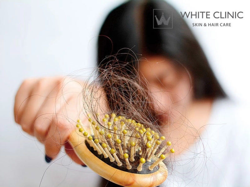 Rụng Tóc Do Thiếu Chất Gì? 5 Vi Chất Thiết Yếu Và Giải Pháp Phục Hồi Nang Tóc