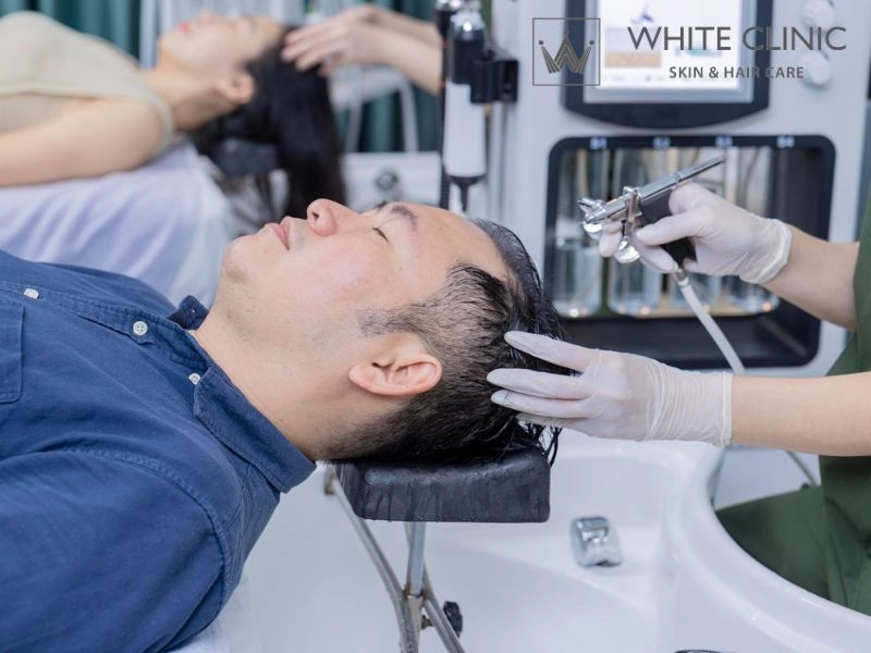 rụng tóc do stress