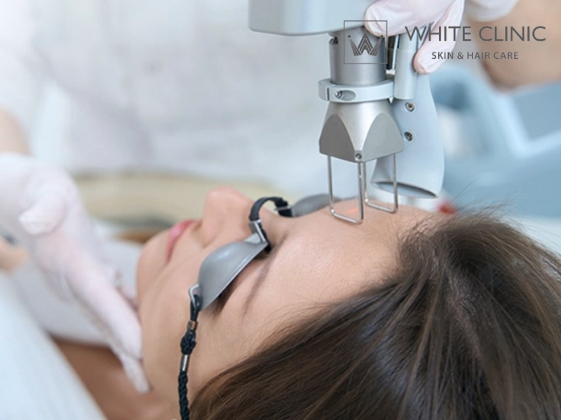 Các Loại Bước Sóng Laser Trong Điều Trị Da Và Ứng Dụng Chuyên Sâu 