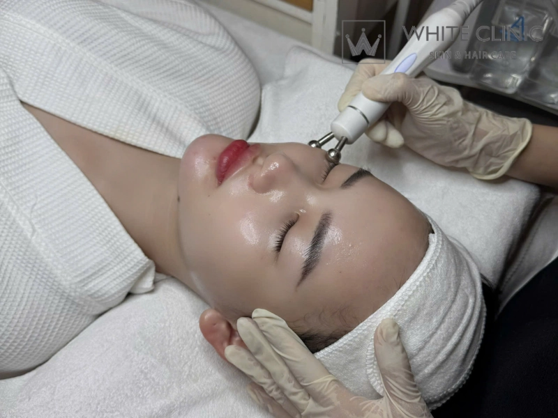 Phác đồ phối hợp - Bí quyết tối ưu hóa kết quả điều trị sẹo Phác đồ phối hợp - Bí quyết tối ưu hóa kết quả điều trị sẹo
