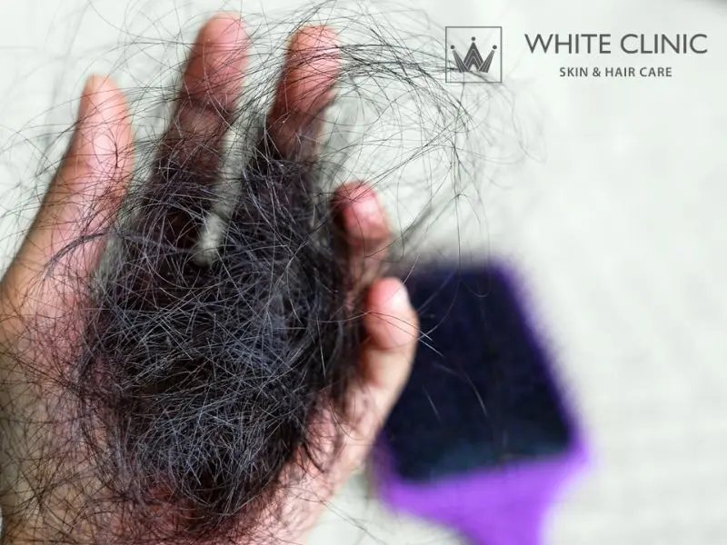 vì sao tóc rụng nhiều ở nữ vì sao tóc rụng nhiều ở nữ