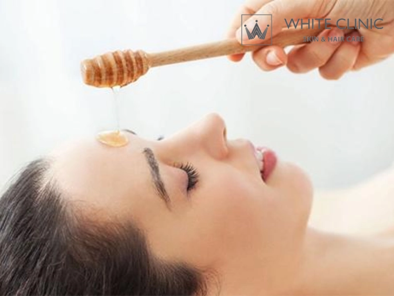 cách làm hết thâm mụn bằng mật ong