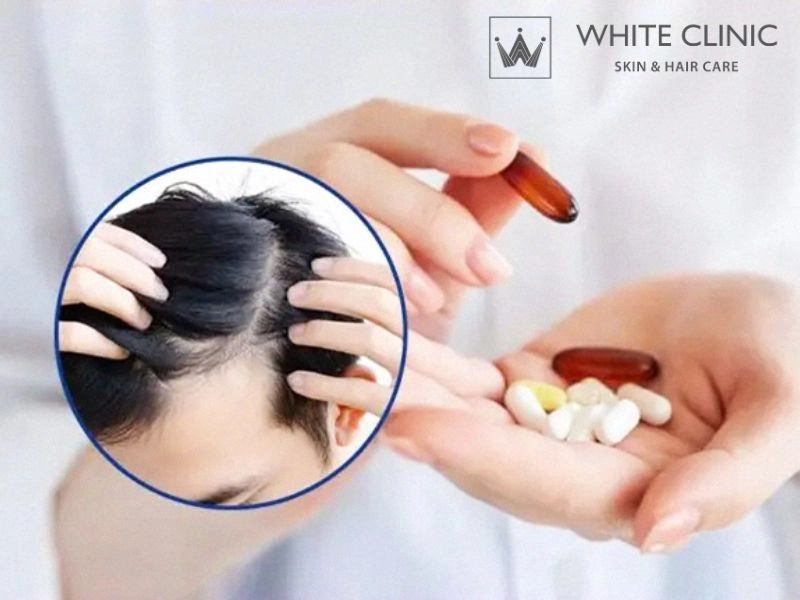 phục hồi nang tóc phục hồi nang tóc