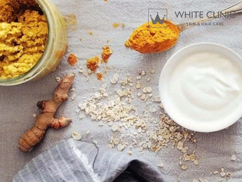 trị mụn bằng nghệ